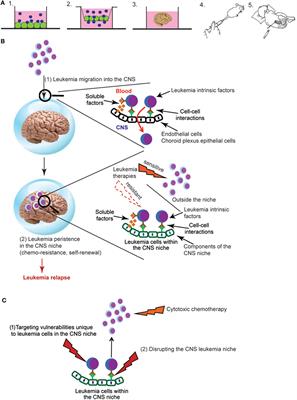 The Role of the Central Nervous System Microenvironment in Pediatric Acute Lymphoblastic Leukemia